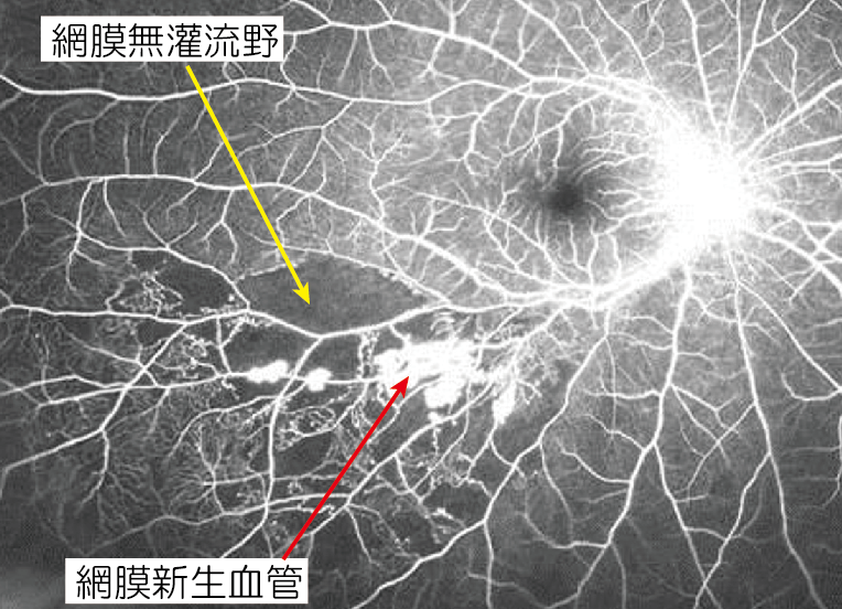 いつ医療援助を受けるべきか